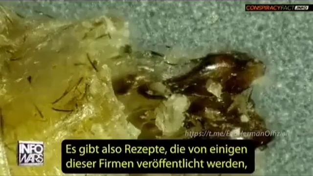 Журналист Майк Адамс представил изображения продуктов питания из насекомых под микроскопом