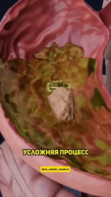 -3928839458711194146