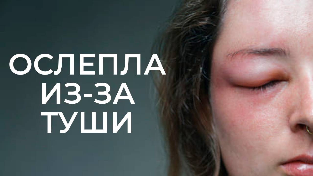 Женщина Ослепла Из-За Туши Для Ресниц - Никогда Не Покупайте Такую Тушь - Ужасная История О Макияже