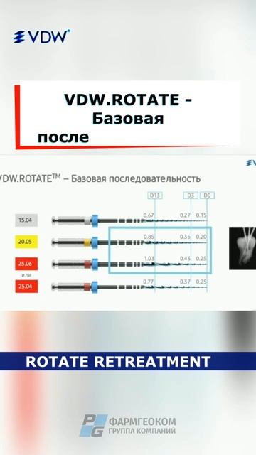 Клинический случай с VDW Rotate 💫 #стоматология #эндо #эндодонтия #реставрация #стоматолог #vdw