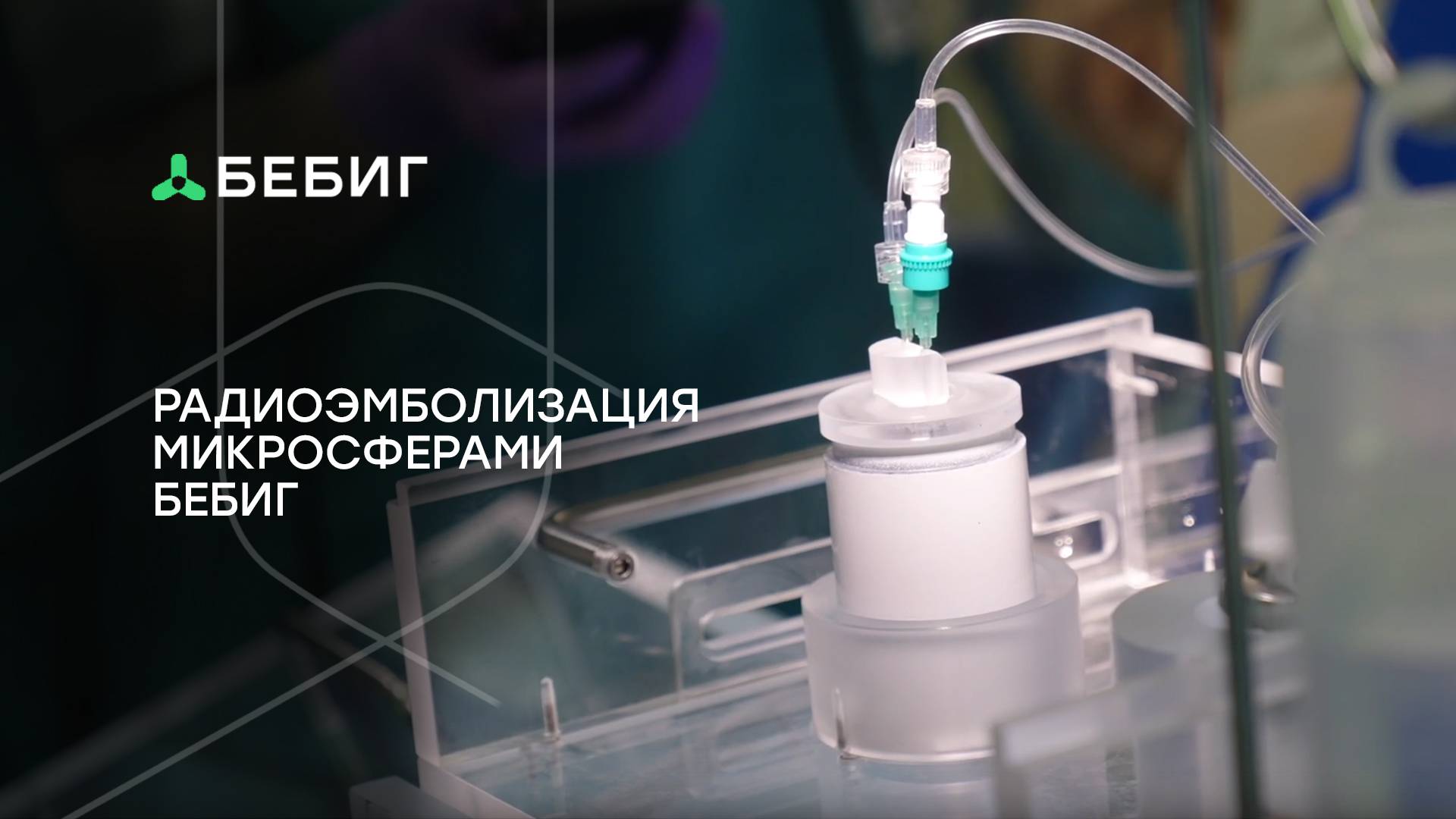 Радиоэмболизация печени микросферами БЕБИГ Обнинском МРНЦ имени  А.Ф. Цыба