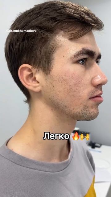 Как изменить кожу за несколько месяцев? 
Ловите простой рецепт в описании⬇️.mp4