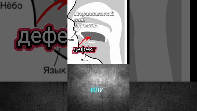 Инфантильный тип глотания