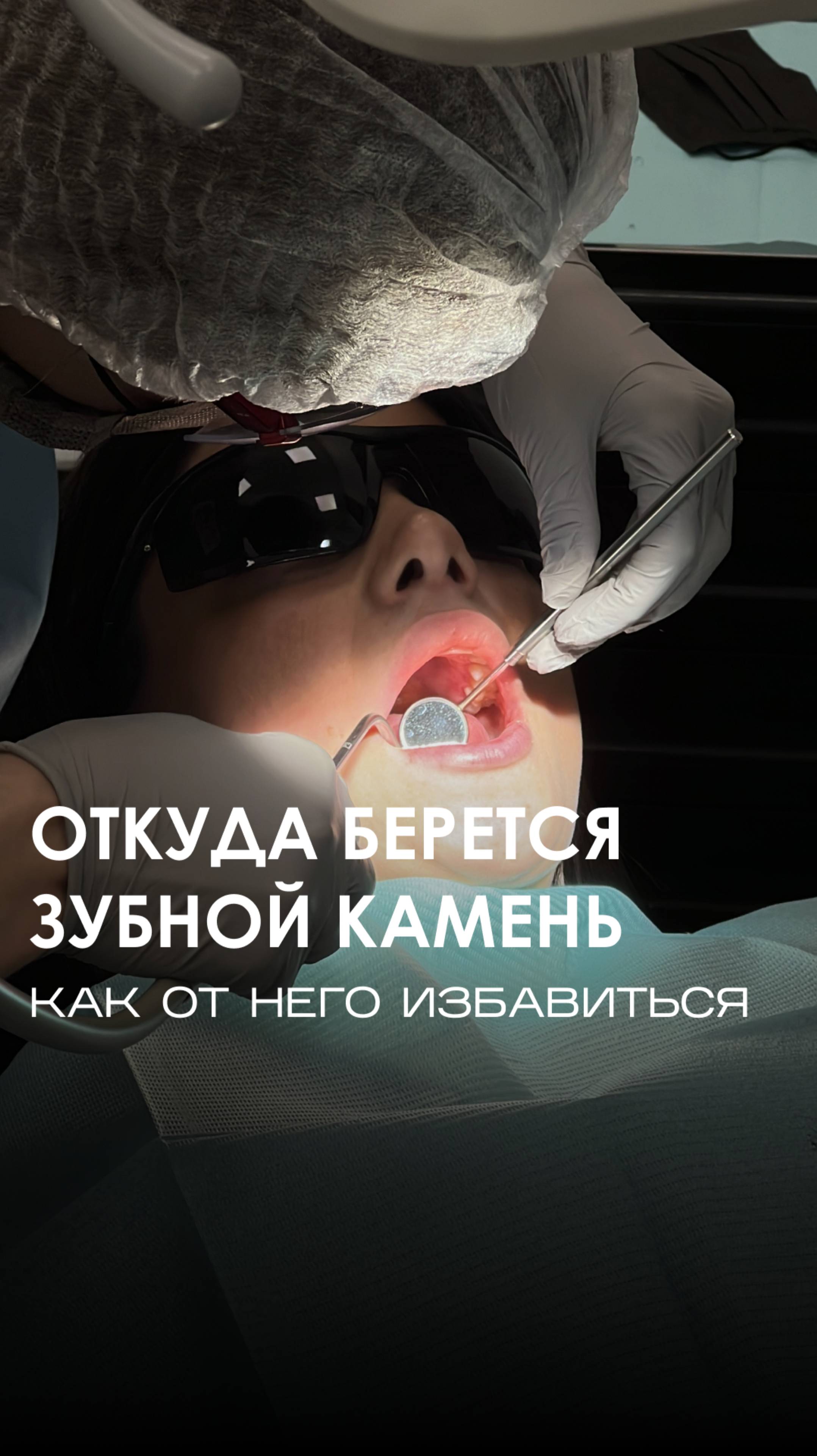 Зубной камень