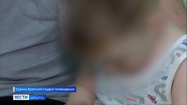 Уголовное дело по статье Халатность возбудили в Братске после нападения собаки на ребенка