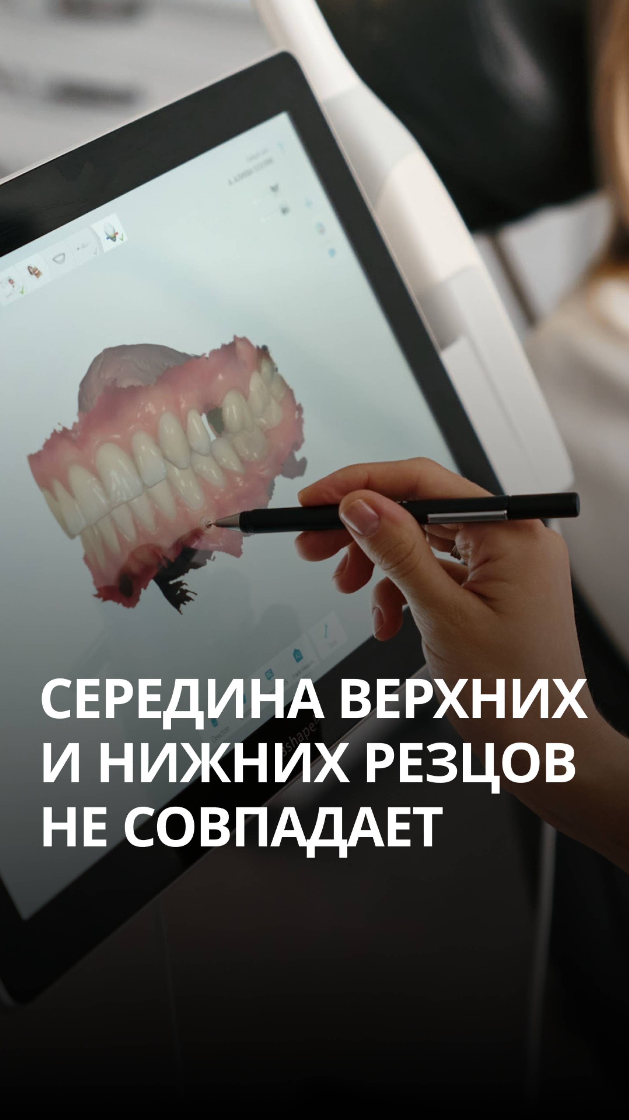 Правильное положение зубов