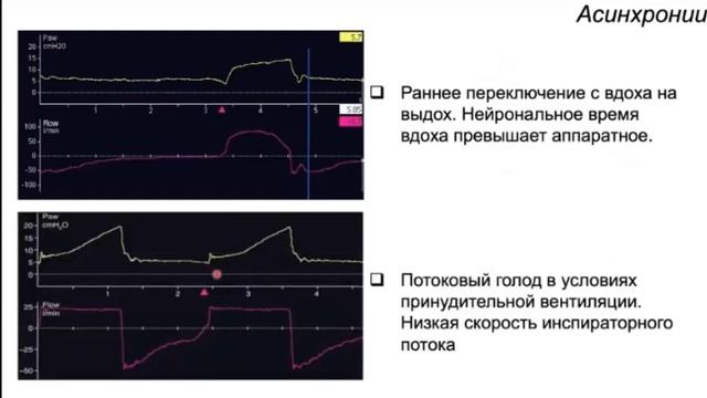 Биомеханика легких Корякин А.Г.