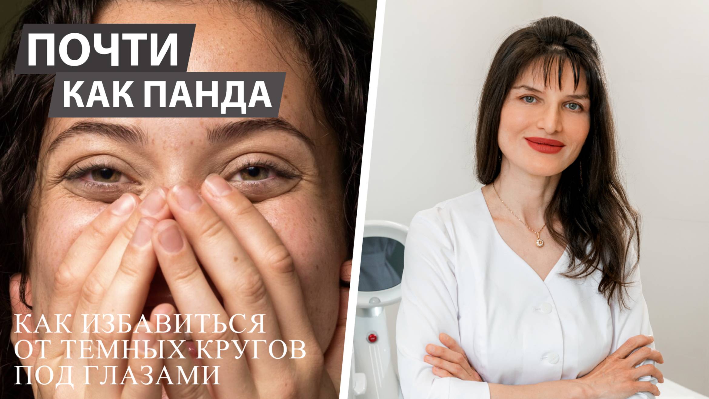 Западения под глазами