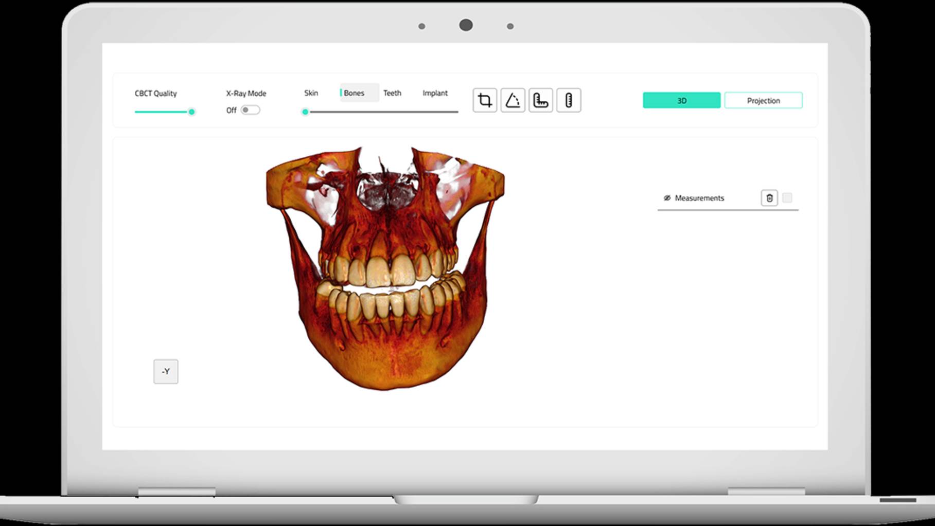 3D Viewer \ DENTOMO