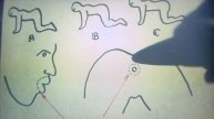 The Human Centipede (2009)