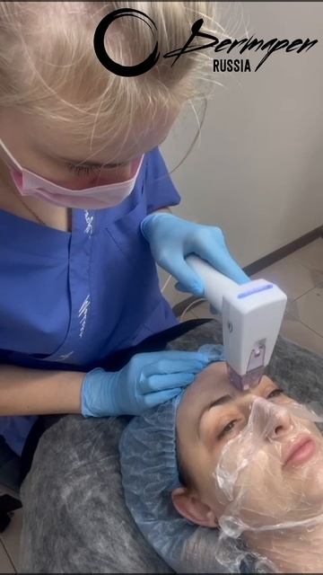 Микроигольчатый РФ на аппарате Dermapen RFNPro.
