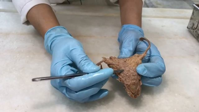 Urinary bladder