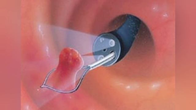 Endoscopy procedures with different types of endoscopes.