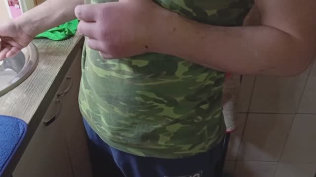 Укус собаки. Подготовка к ремонту. Лепка из пластилина.
