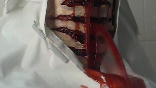 Throat Wound improved