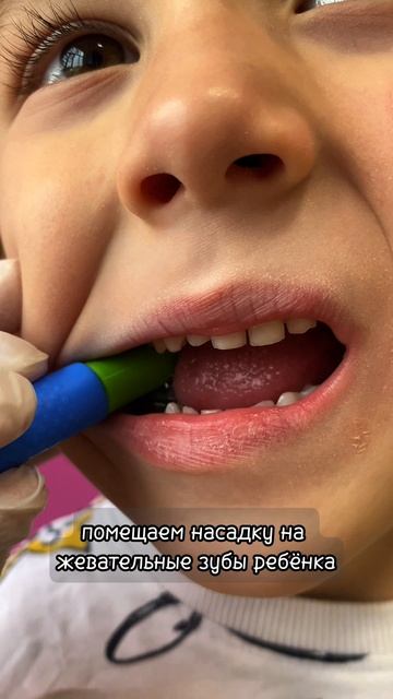 Насадка жевательная Мини