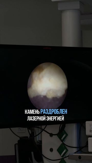 Кислицын, лазер