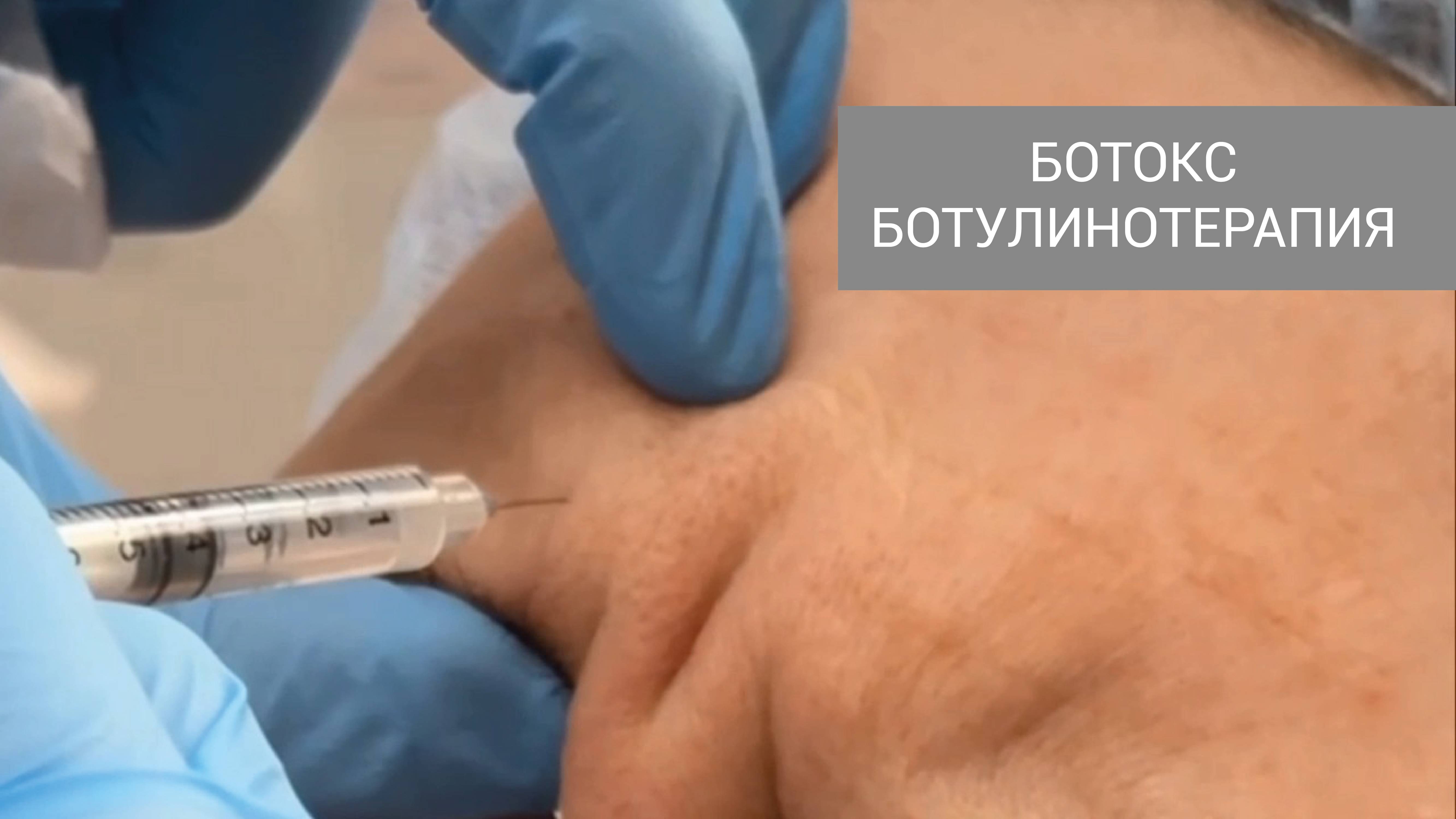 Ботокс в клинике "Артевите"