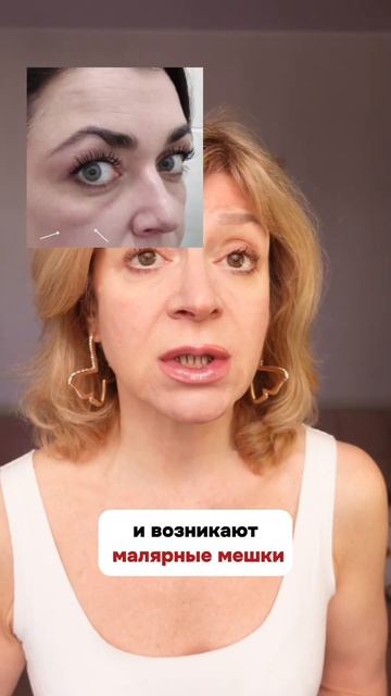 👆МЕШКИ под ГЛАЗАМИ уйдут за 9 минут