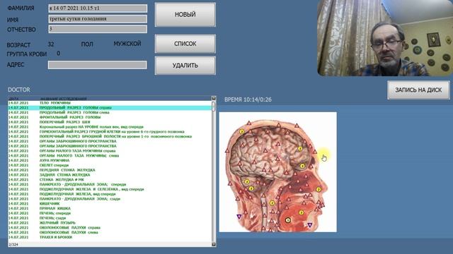 БИОПАТРИОТ.ДЕПРИВАНТ БЕЗ ДЕПРИВАЦИИ,ГОЛОДАНТ БЕЗ ГОЛОДАЦИИ.