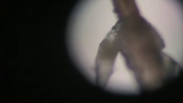 Demodex mites
