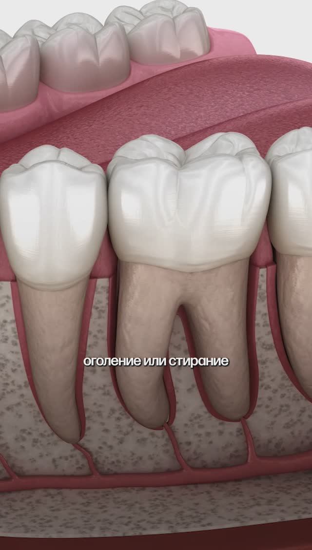 4 причины - чувствительности зубов.