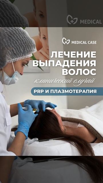 PRP-терапия в трихологии