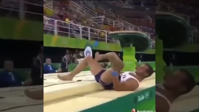 Нога