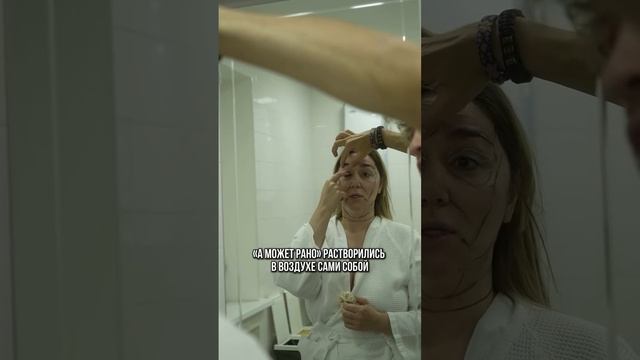 #докторкопасов #пластическийхирургмосква #допосле