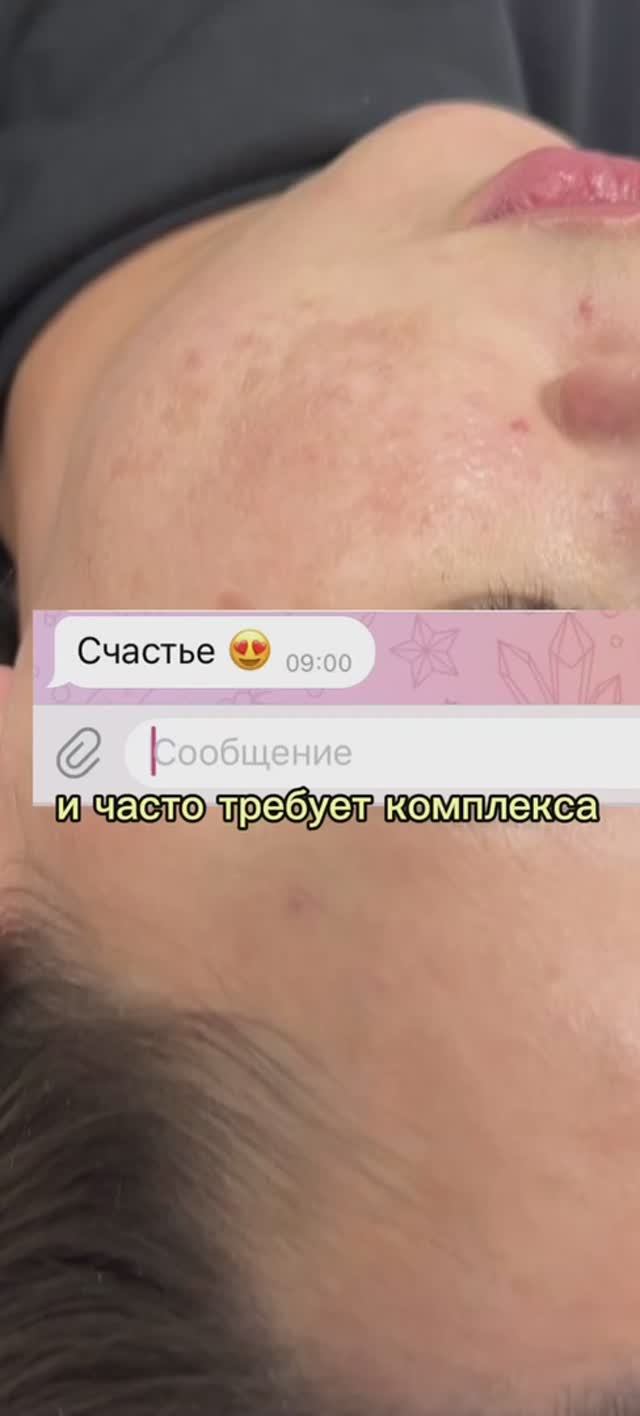 Пошаговая схема от пигментных пятен.
Без регистраций и кодовых слов, в моем тг канале: Belova.doc 💌