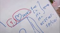 Эти УЗИ нужно сделать обязательно раз в жизни. УЗИ Профилактика .
