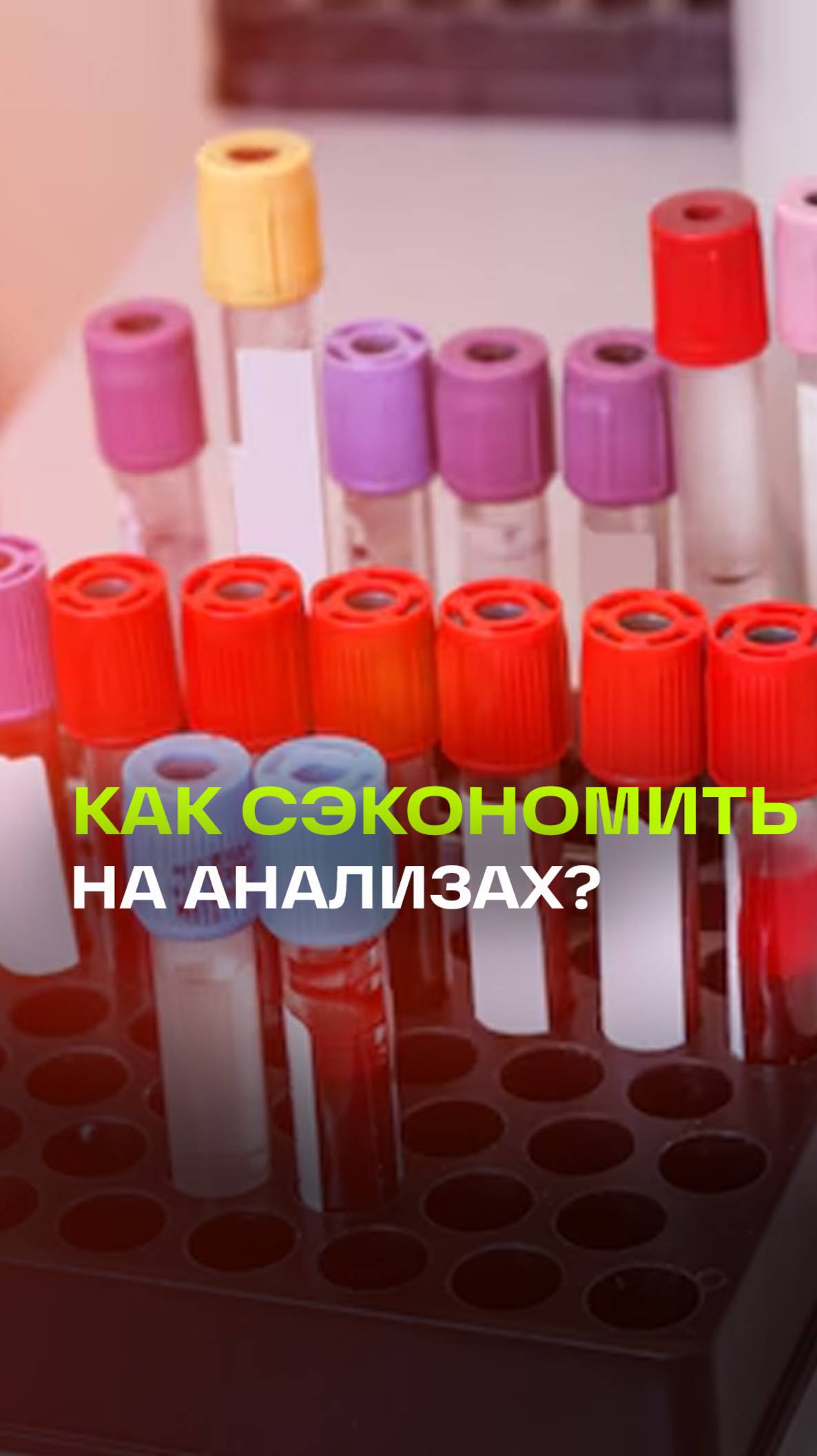 Модернизация лабораторной службы в Подмосковье: экономия и польза для пациентов