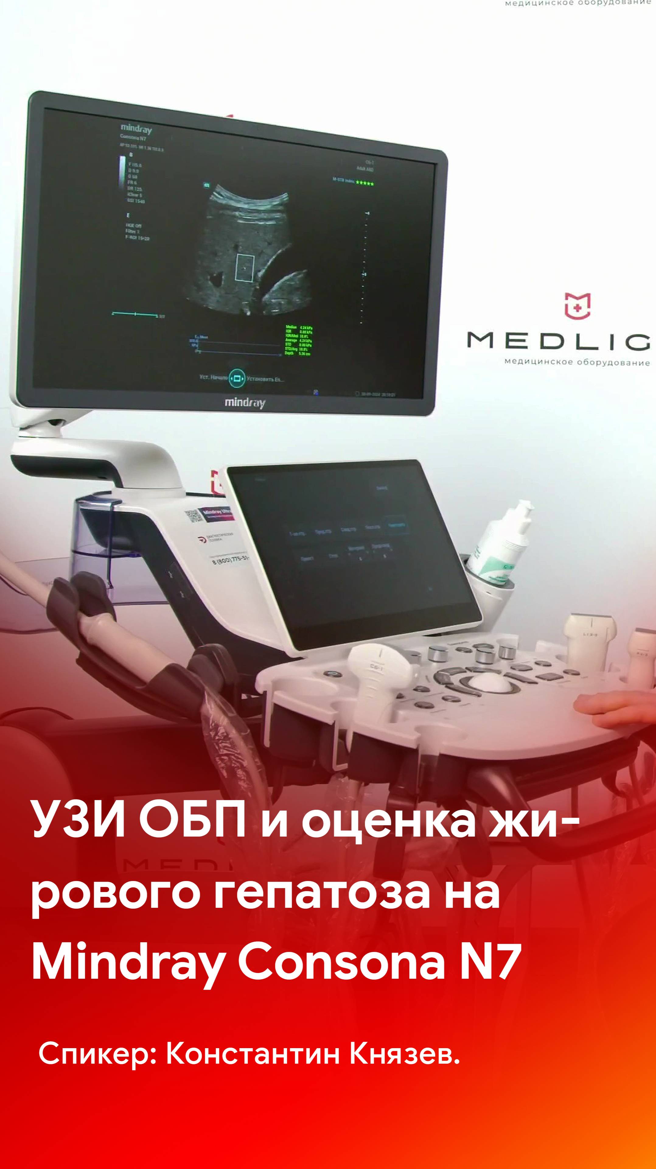 УЗИ аппарат Mindray Consona N7 и диагностика брюшной полости