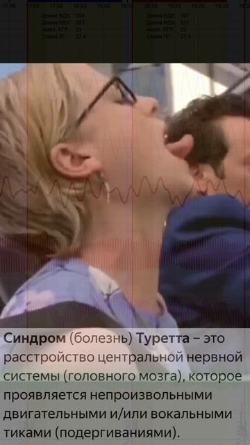 Синдром Туретта.