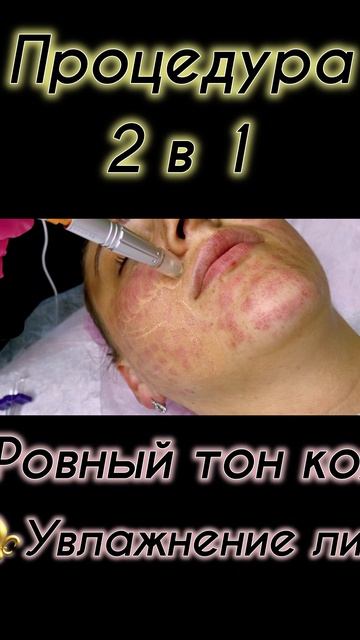 Это работает