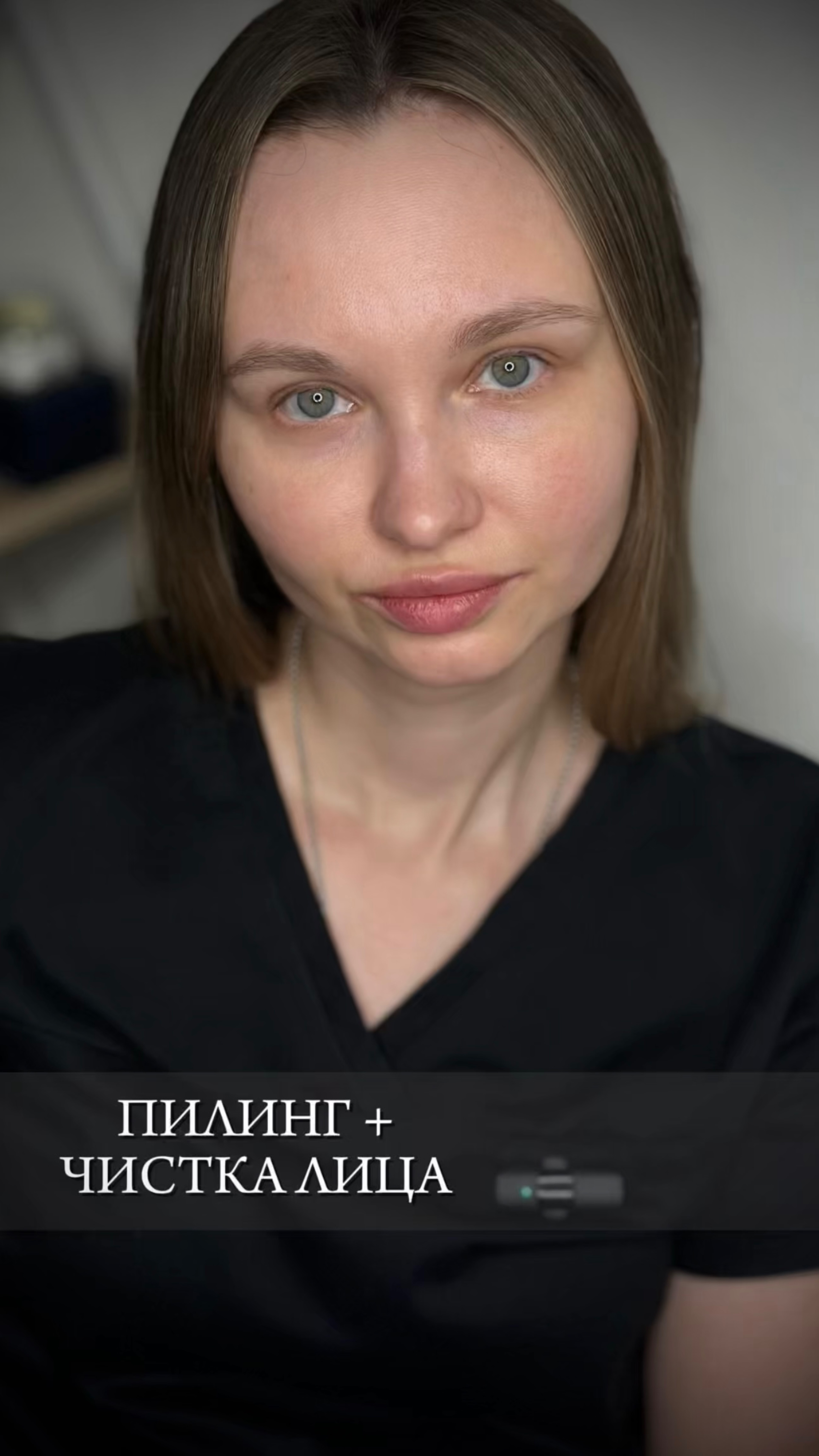 Вся правда о пилингах и чистках лица