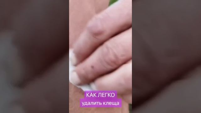 VID-20250328-WA0000.mp4
