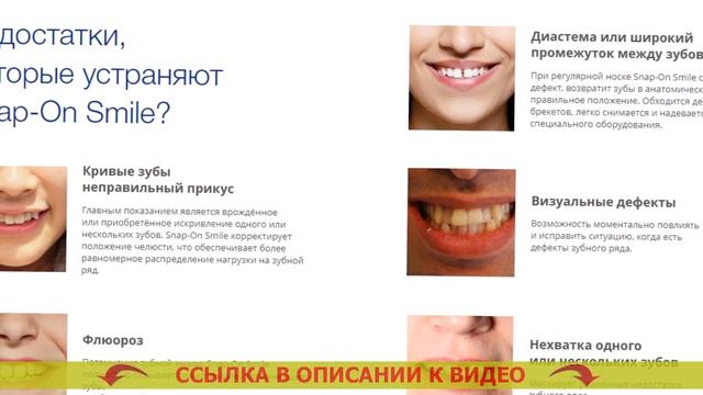 Как установить виниры доктор смайл 🔥 Виниры в караганде стоимость отзывы
