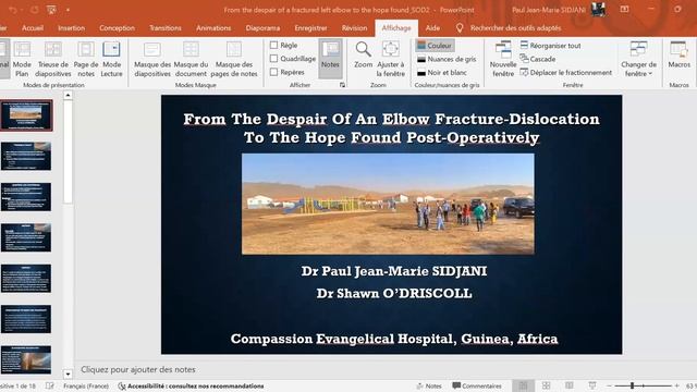 Live Session 1 - Radial Head Fractures
