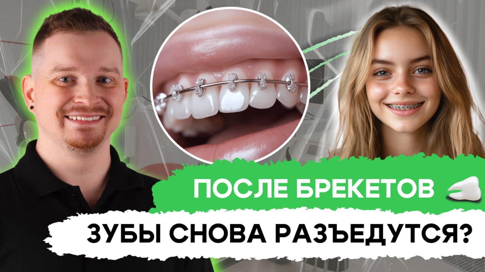 Брекеты: больно ли носить? Брекеты испортят зубы? ВСЕ МИФЫ о брекетах
