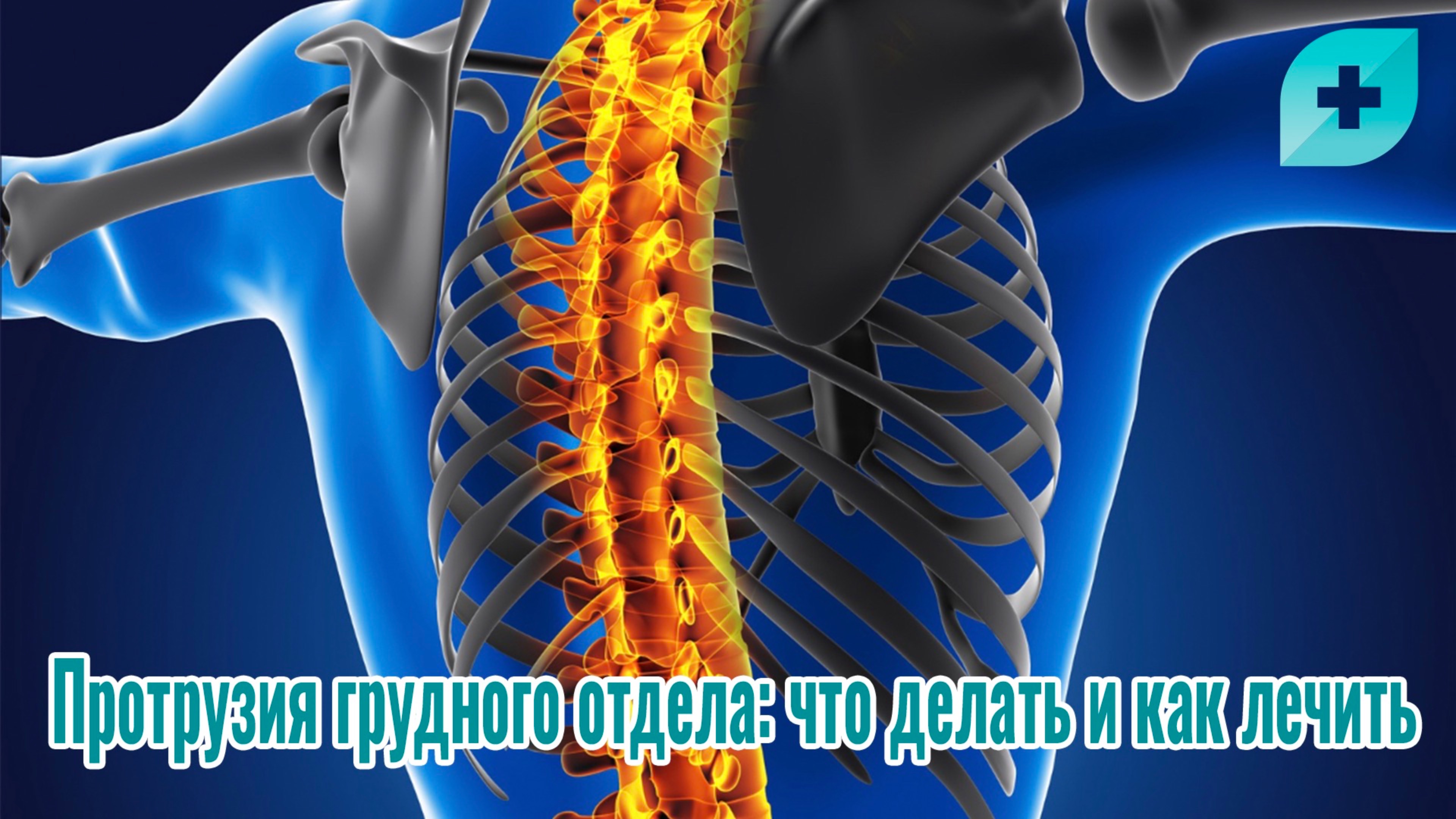 Протрузия грудного отдела: что делать и как лечить