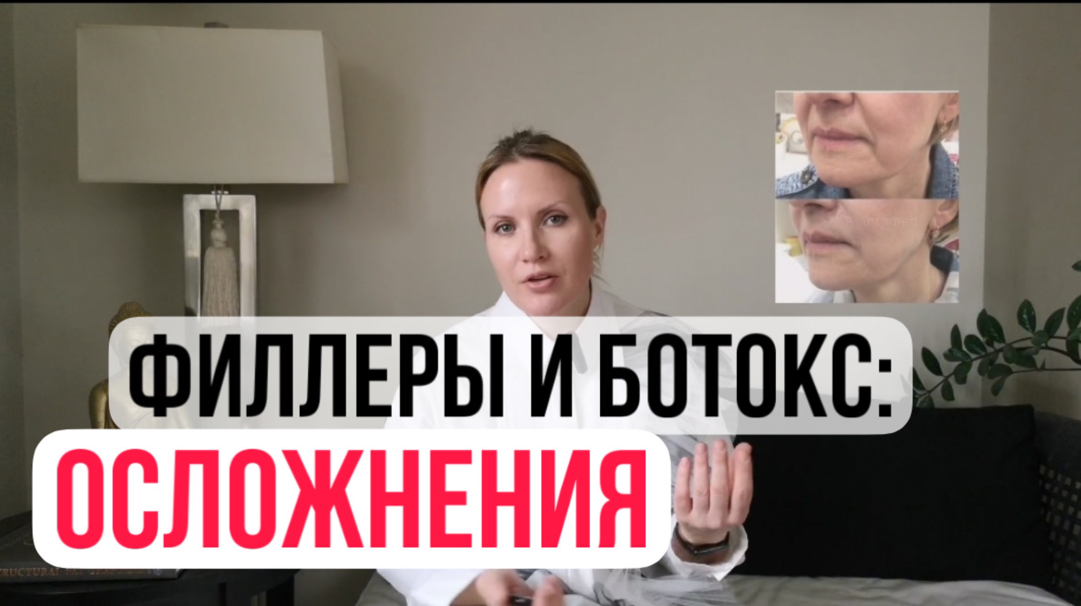 Последствия и опасность после филлер и ботокс у косметолога #уходзакожей #увеличениегуб #омоложени
