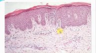 connective tissue part 2 proper