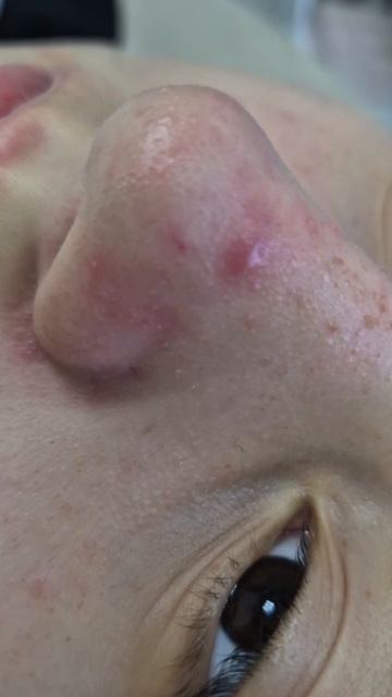 VID_20250401_183456_611.mp4