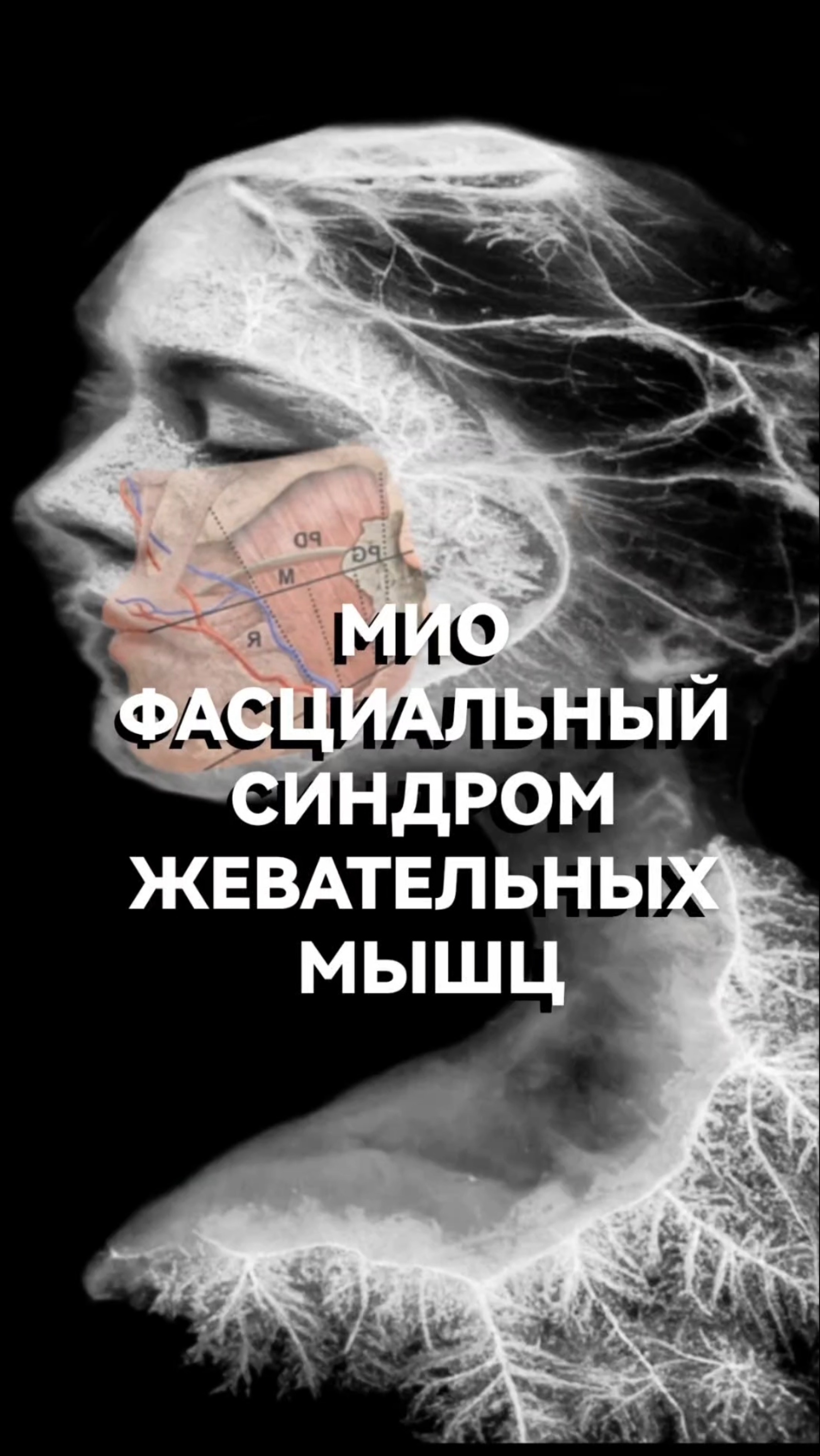 МИОФАСЦИАЛЬНЫЙ СИНДРОМ ЖЕВАТЕЛЬНЫХ МЫШЦ #гнм #психосоматика