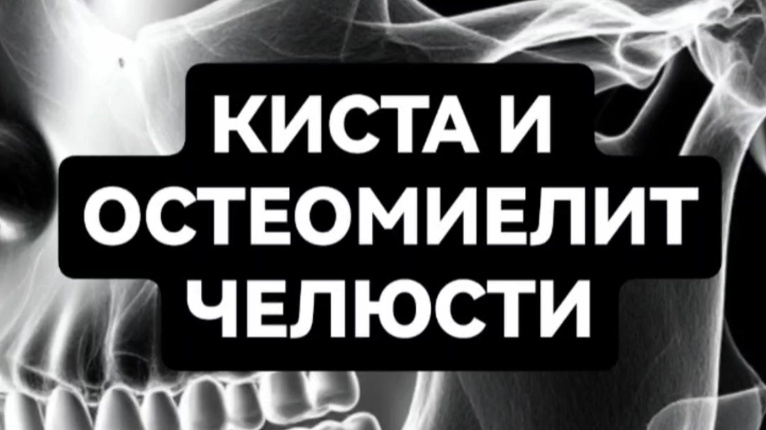 Киста и остеомиелит челюсти