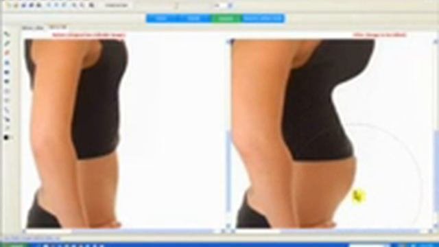 Virtual Plastic Sugery Software And Its Use