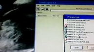 HOW TO INCREASE TORRENTZ SPEED WITH CHEAT ENGINE