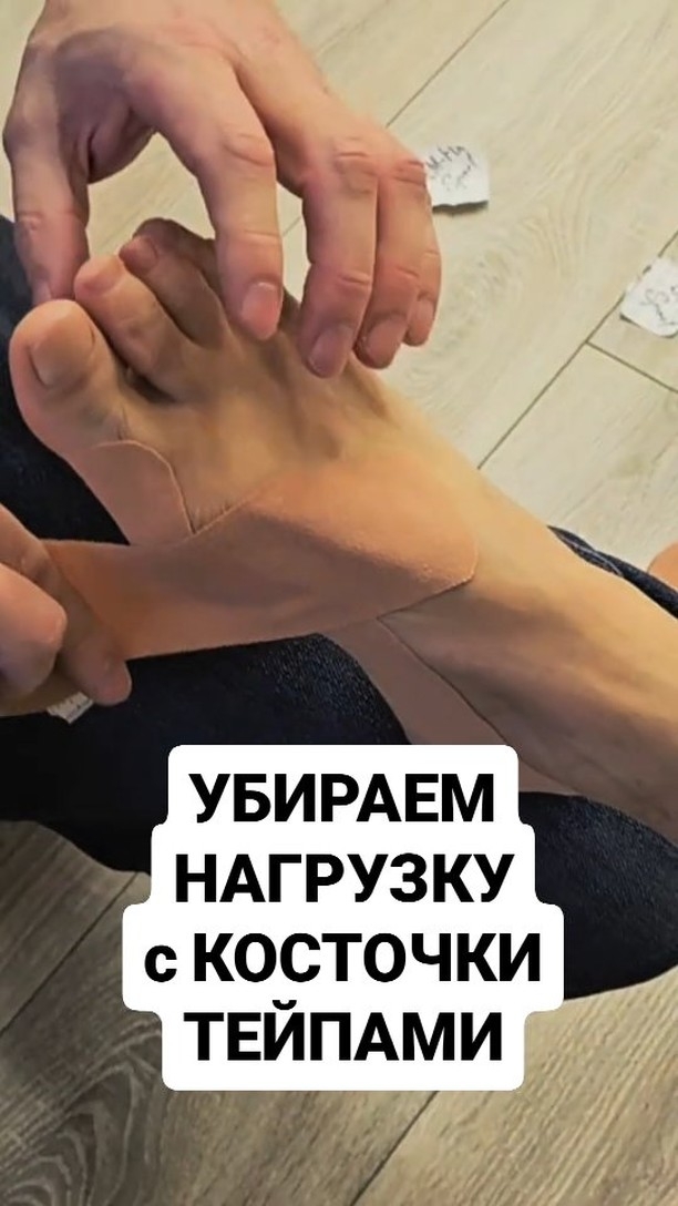 Снижаем НАГРУЗКУ на косточку Тейпами,  но чтобы решить причину косточки нужна дополнительно стелька