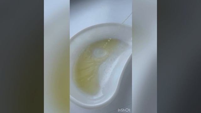 Сбор мочи по Нечипоренко